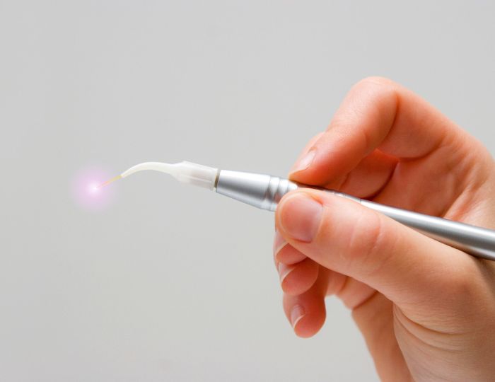 レーザー治療器